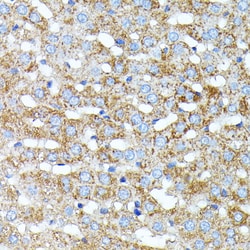 Invitrogen Haptoglobin Polyclonal Antibody 100 &mu;L; Unconjugated:Antibodies,