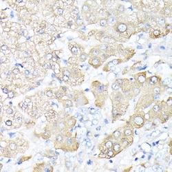 Invitrogen Haptoglobin Polyclonal Antibody 100 &mu;L; Unconjugated:Antibodies,