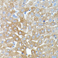 Invitrogen Haptoglobin Polyclonal Antibody 100 &mu;L; Unconjugated:Antibodies,