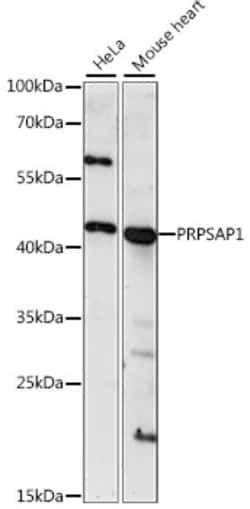 Invitrogen PRPSAP1 Polyclonal Antibody 100 &mu;L; Unconjugated:Antibodies,