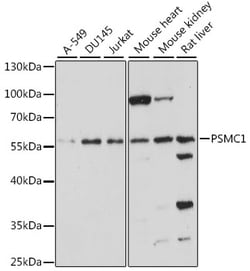 Invitrogen PSMC1 Polyclonal Antibody 100 &mu;L; Unconjugated:Antibodies,