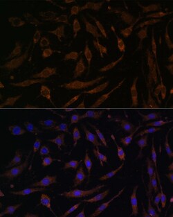 Invitrogen RSK1 Polyclonal Antibody 100 &mu;L; Unconjugated:Antibodies,