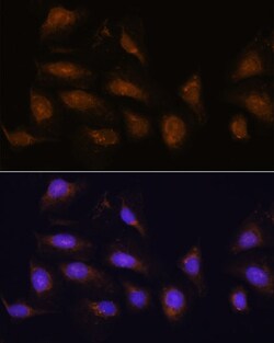 Invitrogen RSK1 Polyclonal Antibody 100 &mu;L; Unconjugated:Antibodies,