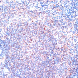 Invitrogen RSK1 Polyclonal Antibody 100 &mu;L; Unconjugated:Antibodies,