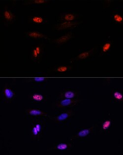 Invitrogen SUMO-3 Polyclonal Antibody 100 &mu;L; Unconjugated:Antibodies,