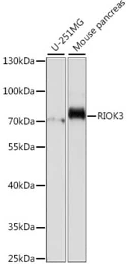 Invitrogen RIOK3 Polyclonal Antibody 100 &mu;L | Buy Online | Invitrogen&trade; | Fisher Scientific