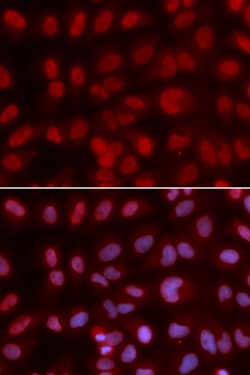 Invitrogen SIN3A Polyclonal Antibody 100 &mu;L; Unconjugated:Antibodies,