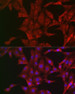 Invitrogen Bim Polyclonal Antibody 100 &mu;L; Unconjugated:Antibodies,