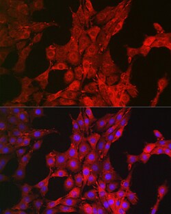 Invitrogen Bim Polyclonal Antibody 100 &mu;L; Unconjugated:Antibodies,