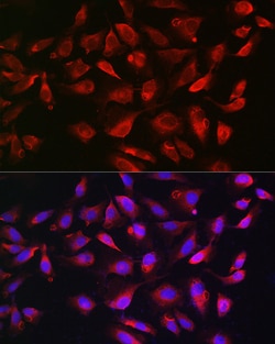 Invitrogen Bim Polyclonal Antibody 100 &mu;L; Unconjugated:Antibodies,