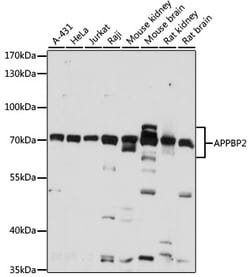 Invitrogen PAT1 Polyclonal Antibody 100 &mu;L; Unconjugated:Antibodies,