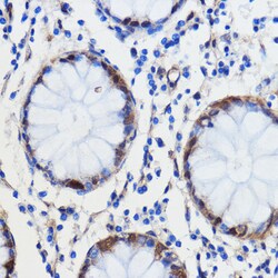 Invitrogen GCAT Polyclonal Antibody 100 &mu;L; Unconjugated:Antibodies,