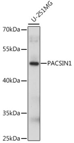 Invitrogen PACSIN1 Polyclonal Antibody 100 &mu;L; Unconjugated:Antibodies,