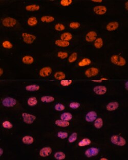 Invitrogen MYEF2 Polyclonal Antibody 100 &mu;L; Unconjugated:Antibodies,