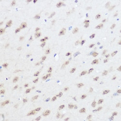 Invitrogen UFM1 Polyclonal Antibody 100 &mu;L | Buy Online | Invitrogen&trade; | Fisher Scientific