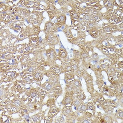 Invitrogen CDK5RAP1 Polyclonal Antibody 100 &mu;L; Unconjugated:Antibodies,