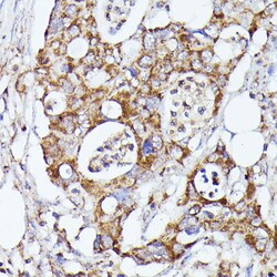 Invitrogen CDK5RAP1 Polyclonal Antibody 100 &mu;L; Unconjugated:Antibodies,
