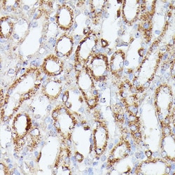 Invitrogen CDK5RAP1 Polyclonal Antibody 100 &mu;L; Unconjugated:Antibodies,