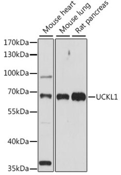 Invitrogen UCKL1 Polyclonal Antibody 100 &mu;L; Unconjugated:Antibodies,