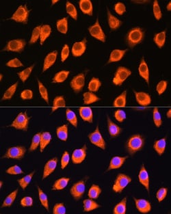 Invitrogen LMBRD1 Polyclonal Antibody 100 &mu;L; Unconjugated:Antibodies,