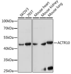 Invitrogen ACTR10 Polyclonal Antibody 100 &mu;L; Unconjugated:Antibodies,