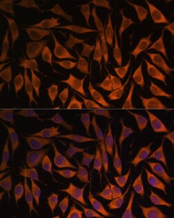 Invitrogen MRPS35 Polyclonal Antibody 100 &mu;L | Buy Online | Invitrogen&trade; | Fisher Scientific