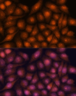 Invitrogen DDX31 Polyclonal Antibody 100 &mu;L; Unconjugated:Antibodies,