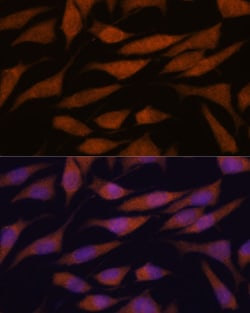 Invitrogen DDX31 Polyclonal Antibody 100 &mu;L; Unconjugated:Antibodies,