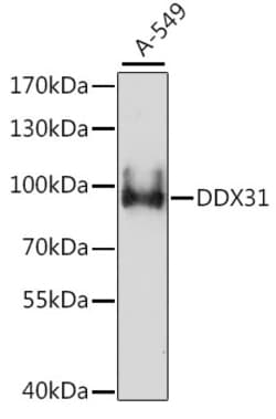 Invitrogen DDX31 Polyclonal Antibody 100 &mu;L; Unconjugated:Antibodies,