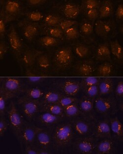 Invitrogen B3GNT4 Polyclonal Antibody 100 &mu;L; Unconjugated:Antibodies,