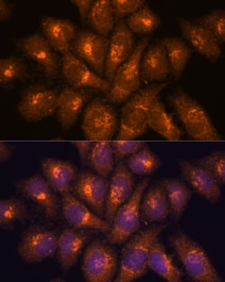 Invitrogen B3GNT4 Polyclonal Antibody 100 &mu;L; Unconjugated:Antibodies,