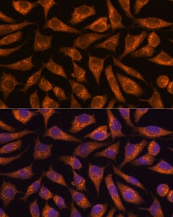 Invitrogen B3GNT4 Polyclonal Antibody 100 &mu;L; Unconjugated:Antibodies,