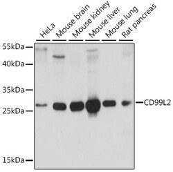Invitrogen CD99L2 Polyclonal Antibody 100 &mu;L; Unconjugated:Antibodies,