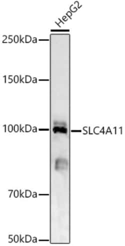 Invitrogen SLC4A11 Polyclonal Antibody 100 &mu;L; Unconjugated:Antibodies,