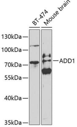 Invitrogen alpha Adducin Polyclonal Antibody 100 &mu;L | Buy Online | Invitrogen&trade; | Fisher Scientific