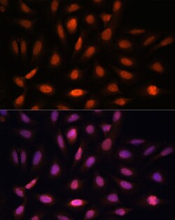Invitrogen PPIL4 Polyclonal Antibody 100 &mu;L; Unconjugated:Antibodies,