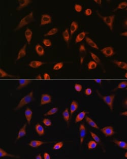 Invitrogen TP53I13 Polyclonal Antibody 100 &mu;L; Unconjugated:Antibodies,