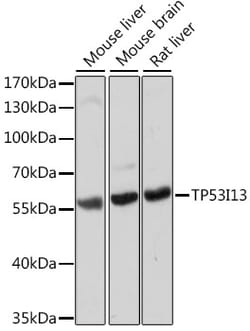 Invitrogen TP53I13 Polyclonal Antibody 100 &mu;L; Unconjugated:Antibodies,