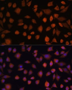 Invitrogen ARMC6 Polyclonal Antibody 100 &mu;L; Unconjugated:Antibodies,