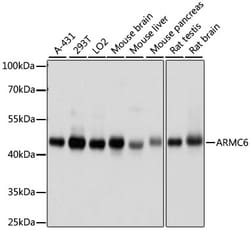 Invitrogen ARMC6 Polyclonal Antibody 100 &mu;L; Unconjugated:Antibodies,