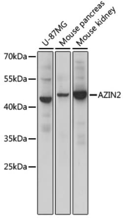 Invitrogen ADC Polyclonal Antibody 100 &mu;L; Unconjugated:Antibodies,