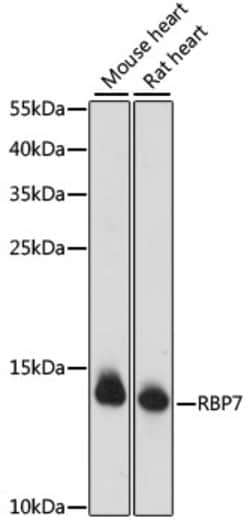 Invitrogen RBP7 Polyclonal Antibody 100 &mu;L; Unconjugated:Antibodies,