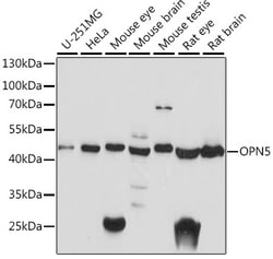 Invitrogen Opsin 5 Polyclonal Antibody 100 &mu;L; Unconjugated:Antibodies,