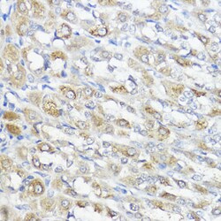 Invitrogen GPX2 Polyclonal Antibody 100 &mu;L | Buy Online | Invitrogen&trade; | Fisher Scientific