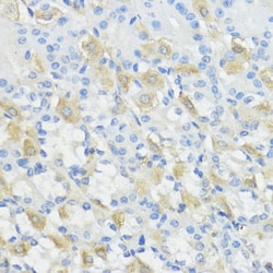 Invitrogen GPX2 Polyclonal Antibody 100 &mu;L | Buy Online | Invitrogen&trade; | Fisher Scientific