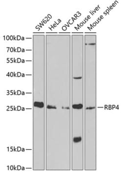 Invitrogen RBP4 Polyclonal Antibody 100 &mu;L; Unconjugated:Antibodies,
