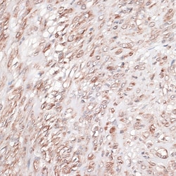 Invitrogen Laminin gamma-1 Polyclonal Antibody 100 &mu;L; Unconjugated:Antibodies,