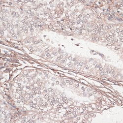 Invitrogen Laminin gamma-1 Polyclonal Antibody 100 &mu;L; Unconjugated:Antibodies,