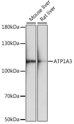 Invitrogen ATP1A3 Polyclonal Antibody 100 &mu;L | Buy Online | Invitrogen&trade; | Fisher Scientific