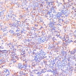 Invitrogen CACNB2 Polyclonal Antibody 100 &mu;L; Unconjugated:Antibodies,